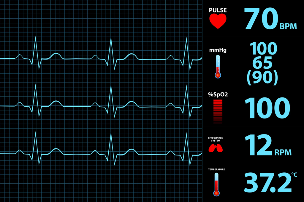 Vital Signs Interactive